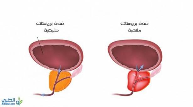      55c1fd8635e41article_1600_1_688825_large.png