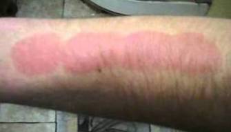 بالفيديو: هكذا يحرقون  أنفسهم عمدًا!!!